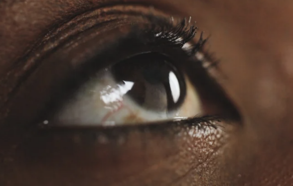 Yeux secs en saison sèche : causes, symptômes et solutions contre l’irritation